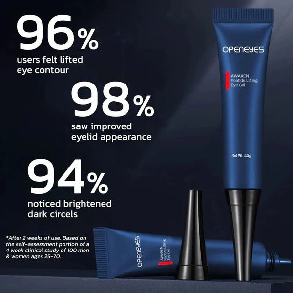 CREMA PARA OJERAS- OPENEYES