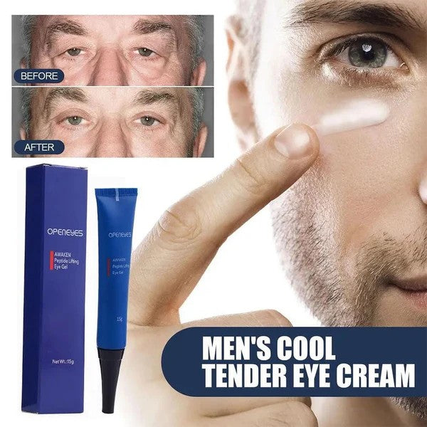 CREMA PARA OJERAS- OPENEYES